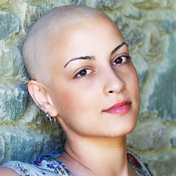 Does Cancer Cause Hair Loss  DanaFarber Cancer Institute